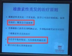 老虎哥哥：一段来自毛发界的权威声音，脱发这样才能治疗好 ... ...