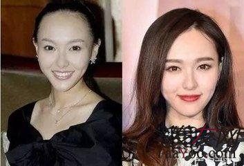 女性脱发：人生若只如初见，何处去寻发际线