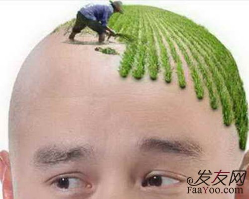 什么季节植发效果好