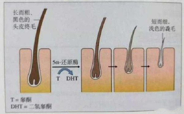 毛囊闭合应该要怎么办