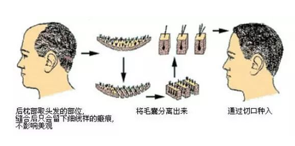 南京新生植发医院怎么样?价格多少?附医院地址+医生信息